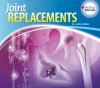 Joint_replacements